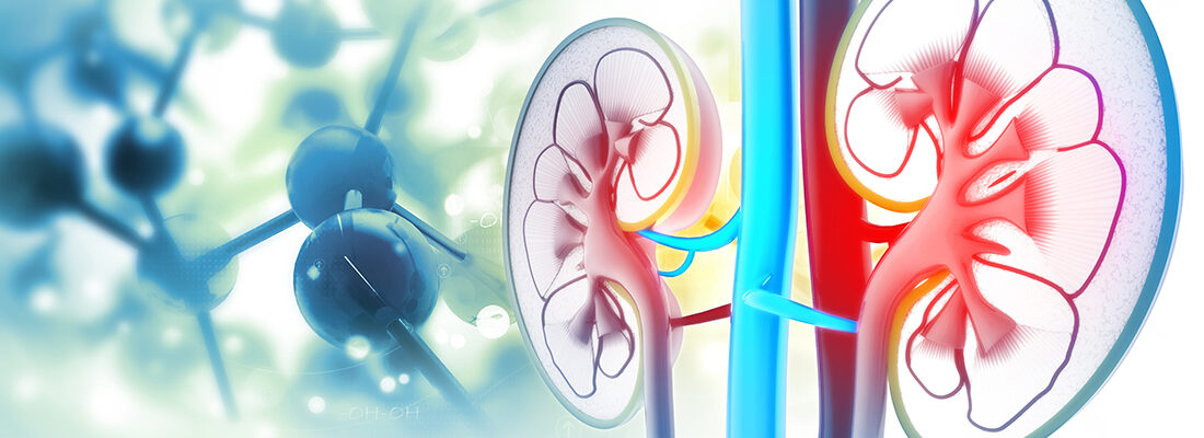 Image for Specific Non-Invasive Diagnosis of Kidney Cancer