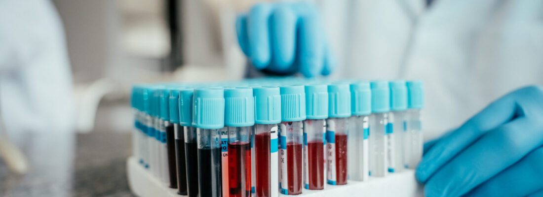 Image for Studying Renin to Improve Sepsis Outcomes