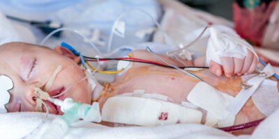 Infant, child in intensive care unit after heart surgery. Shallow depth of field with medical equipment and mother sitting beside the bed. Candid image.